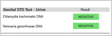 STD urine tests